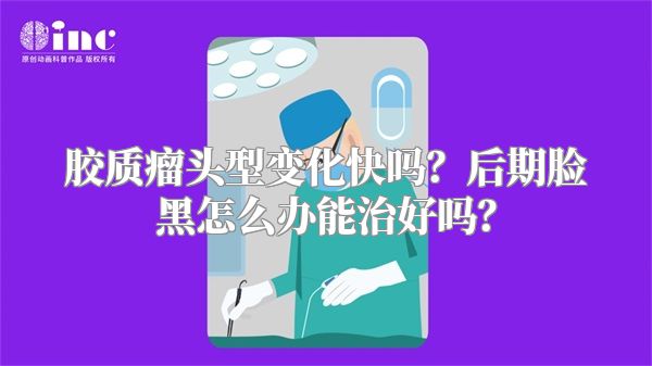 胶质瘤头型变化快吗？后期脸黑怎么办能治好吗？