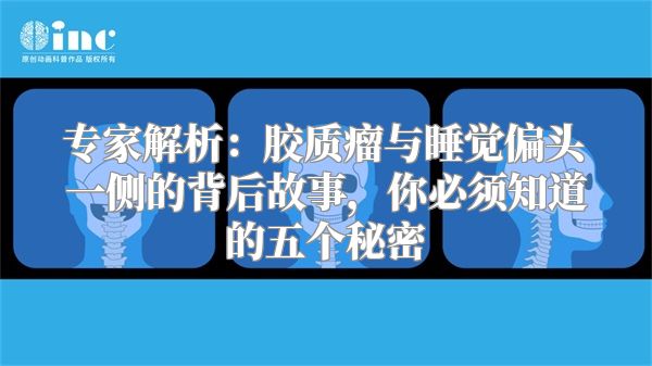 专家解析：胶质瘤与睡觉偏头一侧的背后故事，你必须知道的五个秘密