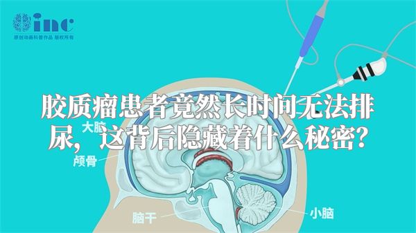 胶质瘤患者竟然长时间无法排尿，这背后隐藏着什么秘密？