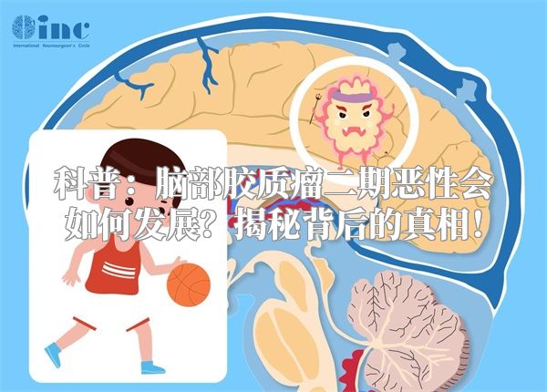 科普：脑部胶质瘤二期恶性会如何发展？揭秘背后的真相！