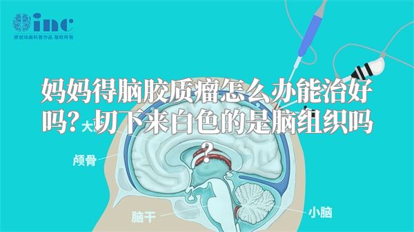 妈妈得脑胶质瘤怎么办能治好吗？切下来白色的是脑组织吗？