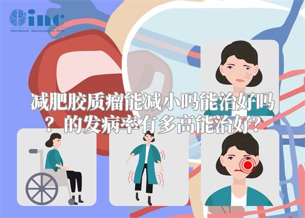 减肥胶质瘤能减小吗能治好吗？的发病率有多高能治好？