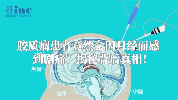 胶质瘤患者竟然会因月经而感到剧痛？揭秘背后真相！