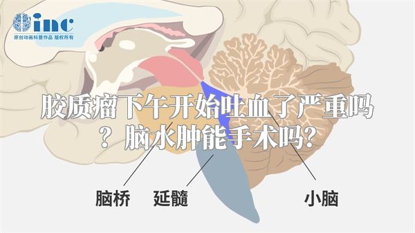 胶质瘤下午开始吐血了严重吗？脑水肿能手术吗？