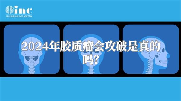 2024年胶质瘤会攻破是真的吗？