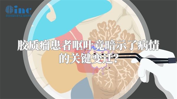 胶质瘤患者呕吐竟暗示了病情的关键变迁？