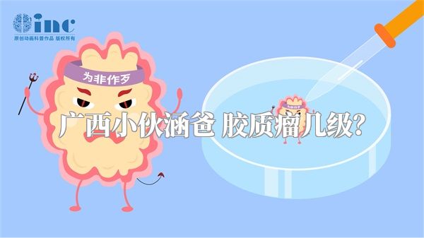 广西小伙涵爸 胶质瘤几级？