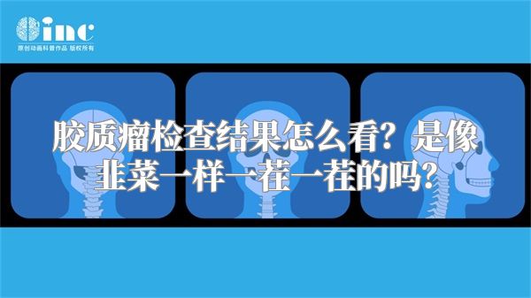胶质瘤检查结果怎么看？是像韭菜一样一茬一茬的吗？