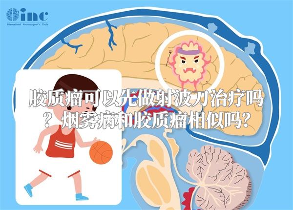 胶质瘤可以先做射波刀治疗吗？烟雾病和胶质瘤相似吗？