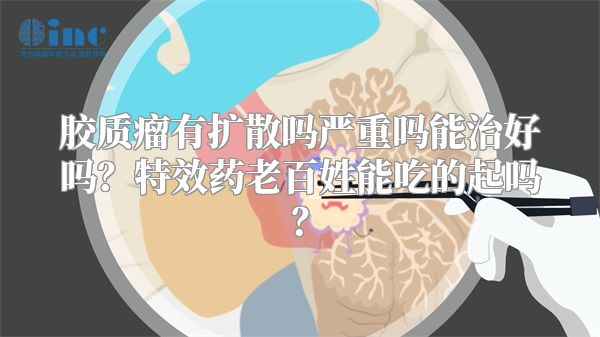 胶质瘤有扩散吗严重吗能治好吗？特效药老百姓能吃的起吗？