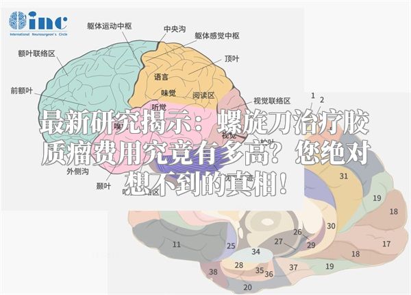 最新研究揭示：螺旋刀治疗胶质瘤费用究竟有多高？您绝对想不到的真相！
