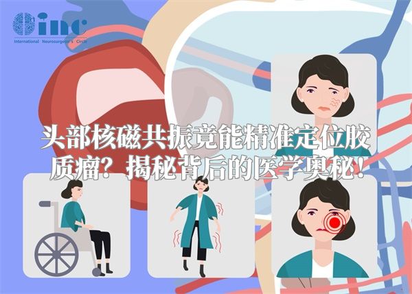 头部核磁共振竟能精准定位胶质瘤？揭秘背后的医学奥秘！