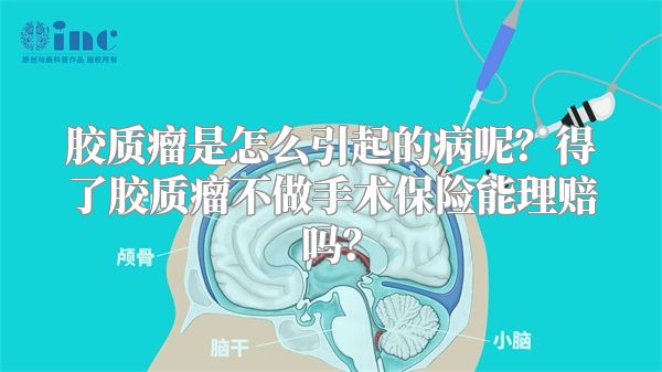 胶质瘤是怎么引起的病呢？得了胶质瘤不做手术保险能理赔吗？