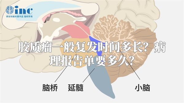 胶质瘤一般复发时间多长？病理报告单要多久？