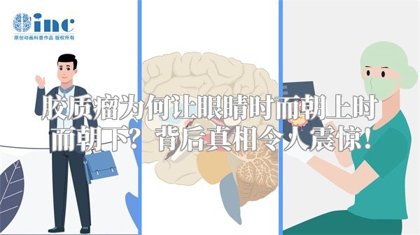 胶质瘤为何让眼睛时而朝上时而朝下？背后真相令人震惊！
