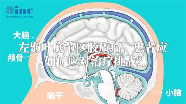 左颞叶底节区胶质瘤，患者应如何应对治疗挑战？