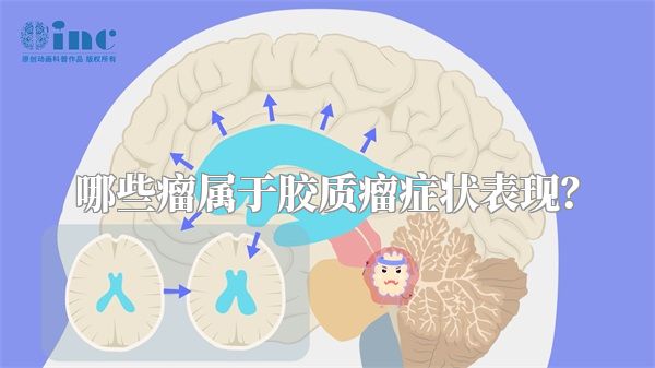 哪些瘤属于胶质瘤症状表现？