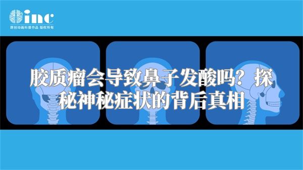 胶质瘤会导致鼻子发酸吗？探秘神秘症状的背后真相