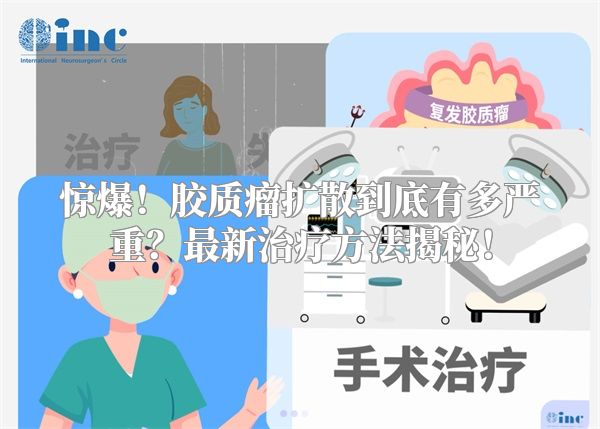 惊爆！胶质瘤扩散到底有多严重？最新治疗方法揭秘！