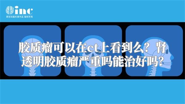 胶质瘤可以在ct上看到么？肾透明胶质瘤严重吗能治好吗？