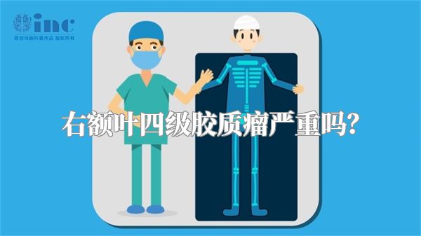 右额叶四级胶质瘤严重吗？