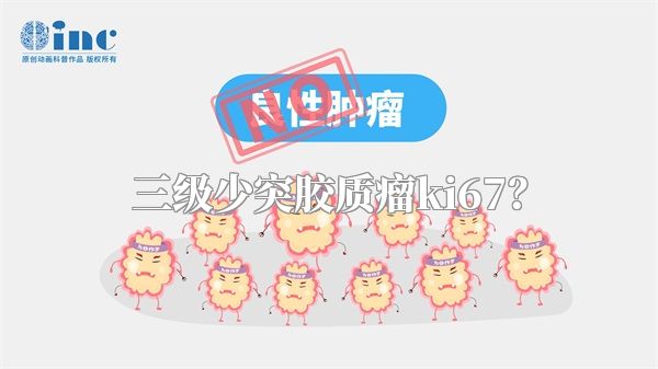 三级少突胶质瘤ki67？