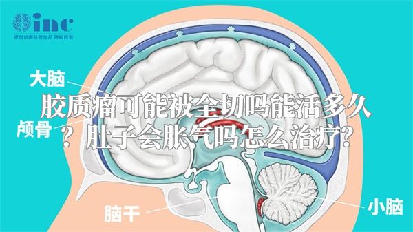 胶质瘤可能被全切吗能活多久？肚子会胀气吗怎么治疗？