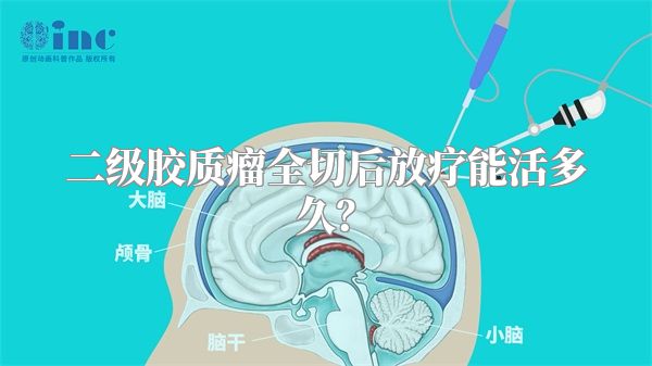 二级胶质瘤全切后放疗能活多久？