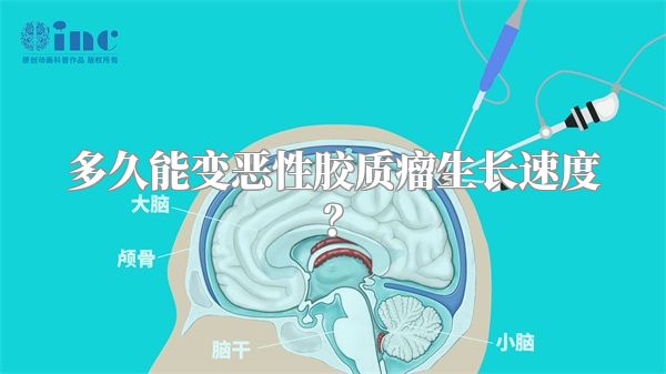 多久能变恶性胶质瘤生长速度？