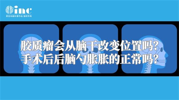 胶质瘤会从脑干改变位置吗？手术后后脑勺胀胀的正常吗？