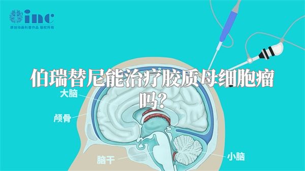 伯瑞替尼能治疗胶质母细胞瘤吗？
