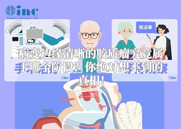 病变边缘清晰的胶质瘤究竟属于哪个阶段？你绝对想不到的真相！