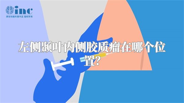 左侧颞叶内侧胶质瘤在哪个位置？