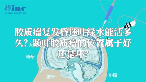 胶质瘤复发昏迷吐绿水能活多久？颞叶胶质瘤的位置属于好还是坏？