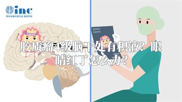 胶质瘤4级脑干处有积液？眼睛红了怎么办？
