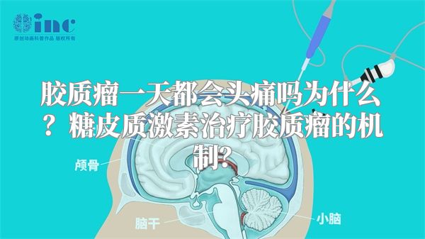 胶质瘤一天都会头痛吗为什么？糖皮质激素治疗胶质瘤的机制？