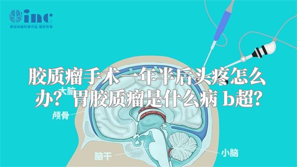 胶质瘤手术一年半后头疼怎么办？胃胶质瘤是什么病 b超？