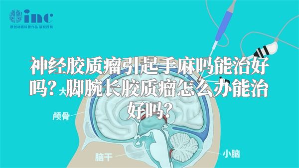神经胶质瘤引起手麻吗能治好吗？脚腕长胶质瘤怎么办能治好吗？
