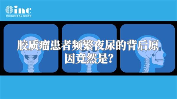 胶质瘤患者频繁夜尿的背后原因竟然是？