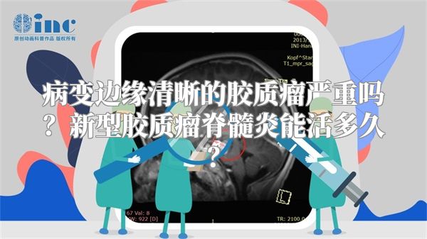 病变边缘清晰的胶质瘤严重吗？新型胶质瘤脊髓炎能活多久？