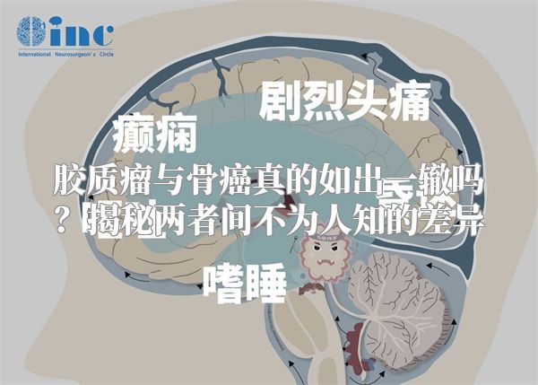 胶质瘤与骨癌真的如出一辙吗？揭秘两者间不为人知的差异