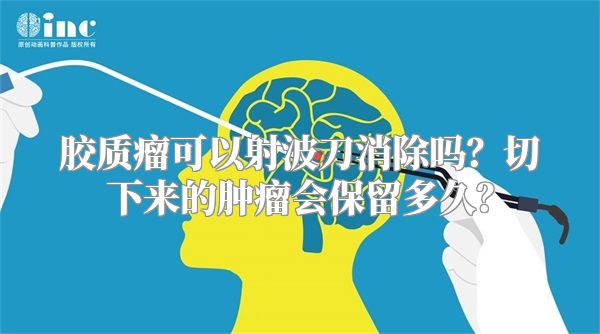 胶质瘤可以射波刀消除吗？切下来的肿瘤会保留多久？