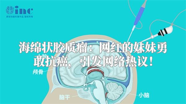 海绵状胶质瘤：网红的妹妹勇敢抗癌，引发网络热议！