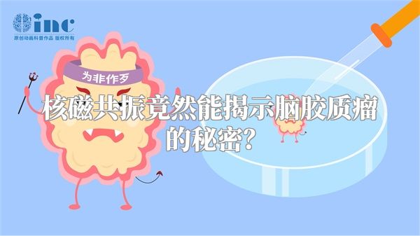 核磁共振竟然能揭示脑胶质瘤的秘密？