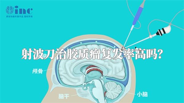射波刀治胶质瘤复发率高吗？