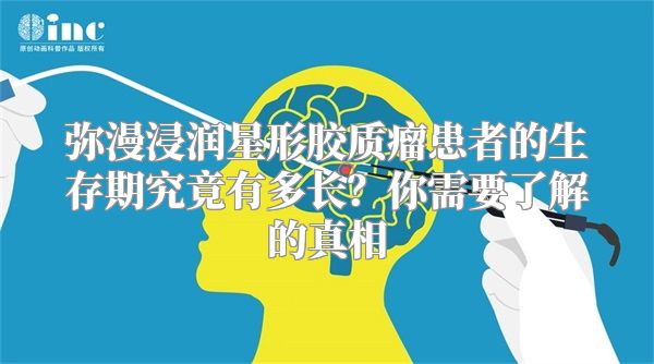 弥漫浸润星形胶质瘤患者的生存期究竟有多长？你需要了解的真相