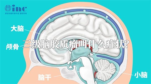 三级脑胶质瘤叫什么症状？