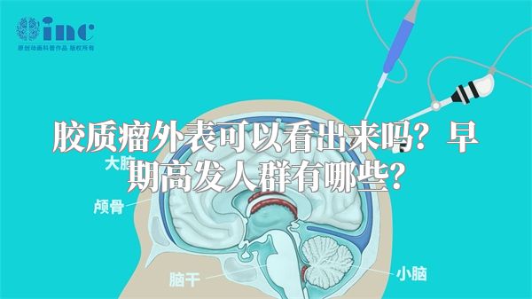 胶质瘤外表可以看出来吗？早期高发人群有哪些？