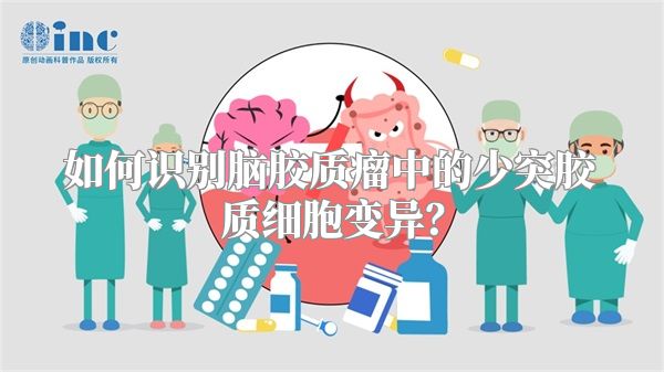 如何识别脑胶质瘤中的少突胶质细胞变异？