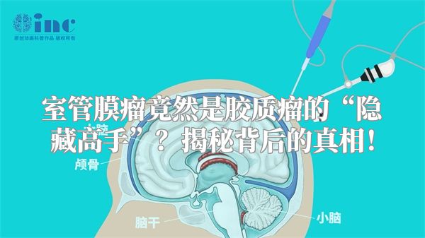 室管膜瘤竟然是胶质瘤的“隐藏高手”？揭秘背后的真相！